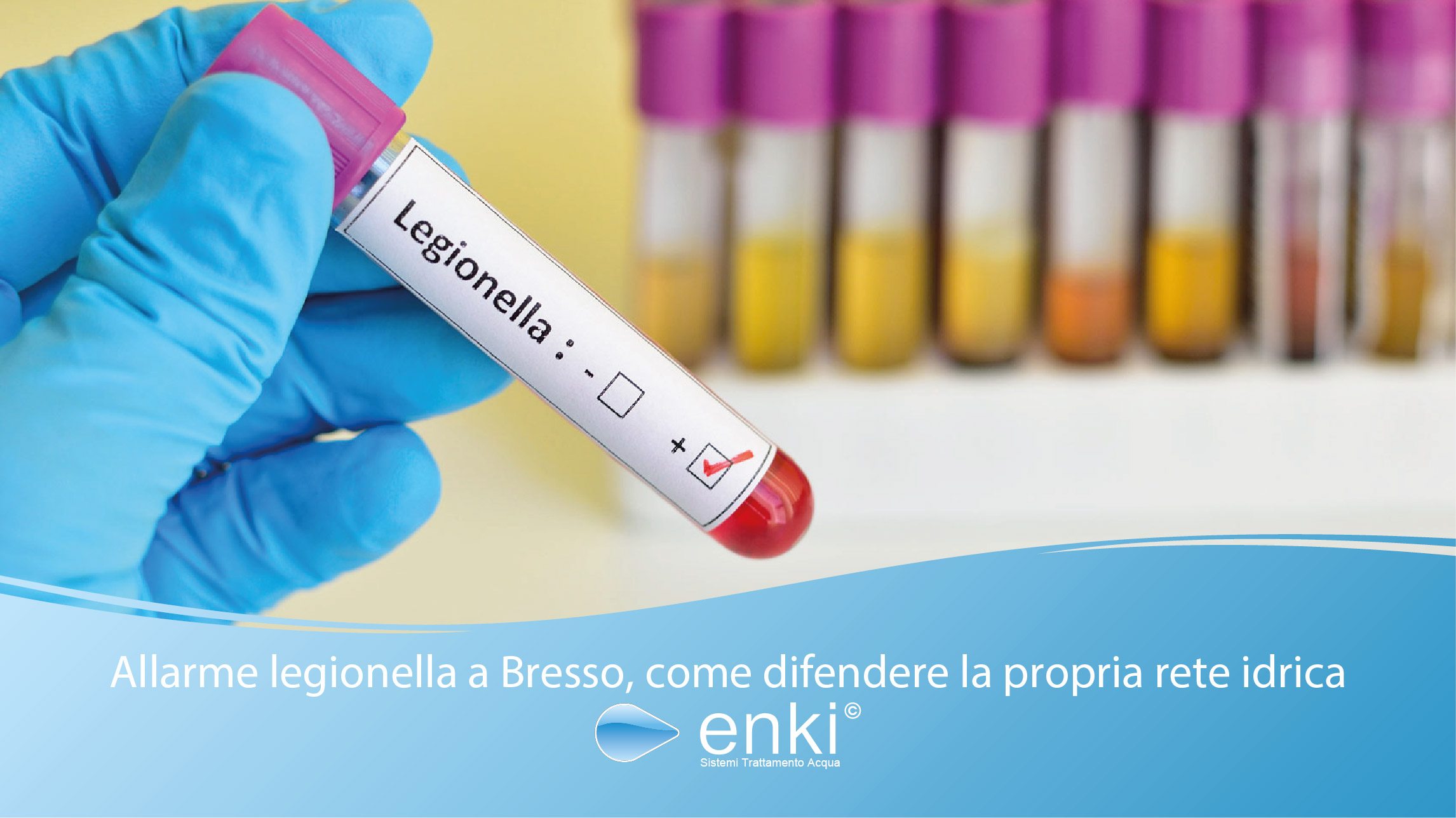 legionella a Bresso | Enki Water srl